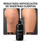 DERMODELUXE – Emulsión Corporal Anticelulitis, Antiflacidez y Efecto Drenante
