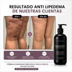 DERMODELUXE – Emulsión Corporal Anticelulitis, Antiflacidez y Efecto Drenante