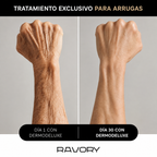 DERMODELUXE – Emulsión Corporal Anticelulitis, Antiflacidez y Efecto Drenante