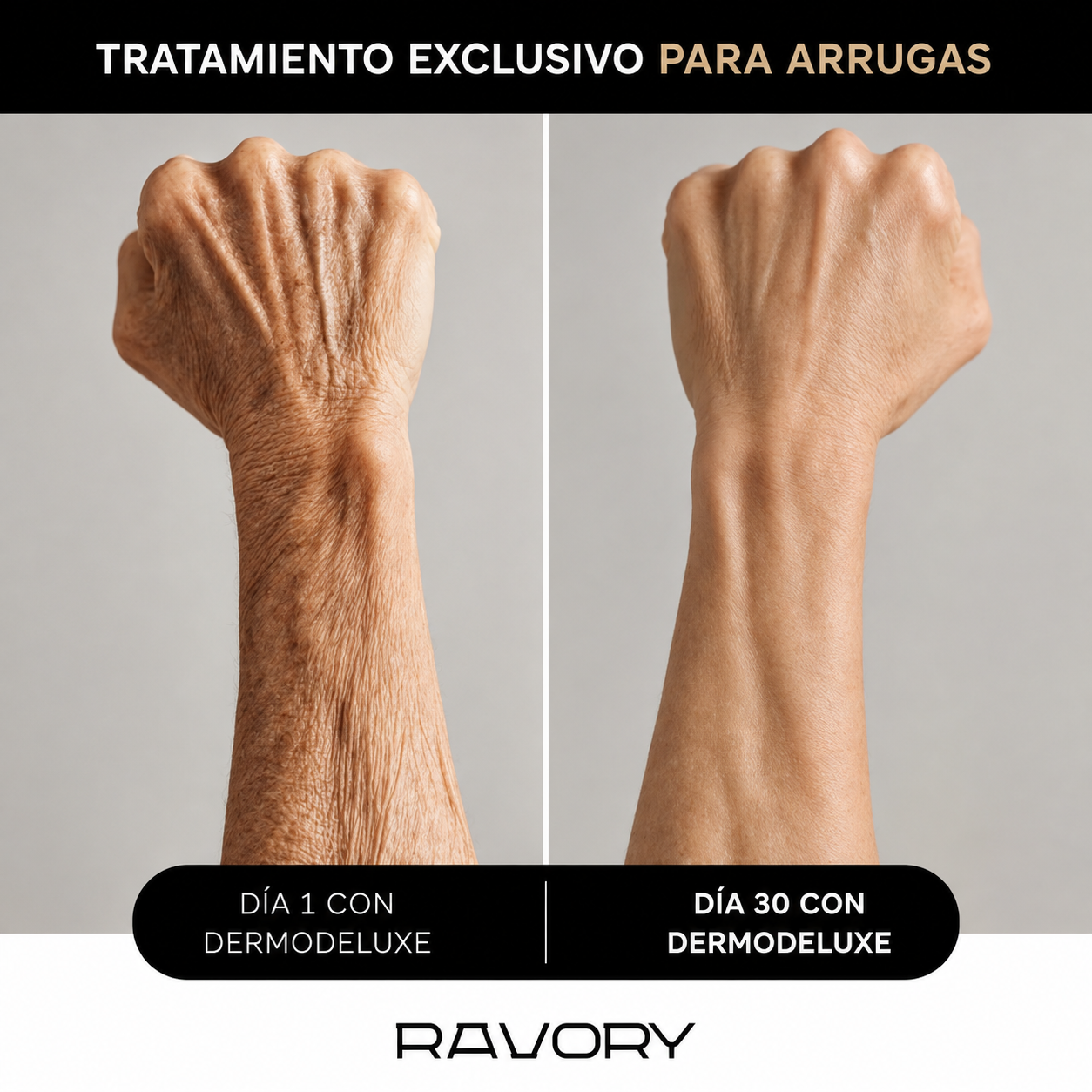 DERMODELUXE – Emulsión Corporal Anticelulitis, Antiflacidez y Efecto Drenante